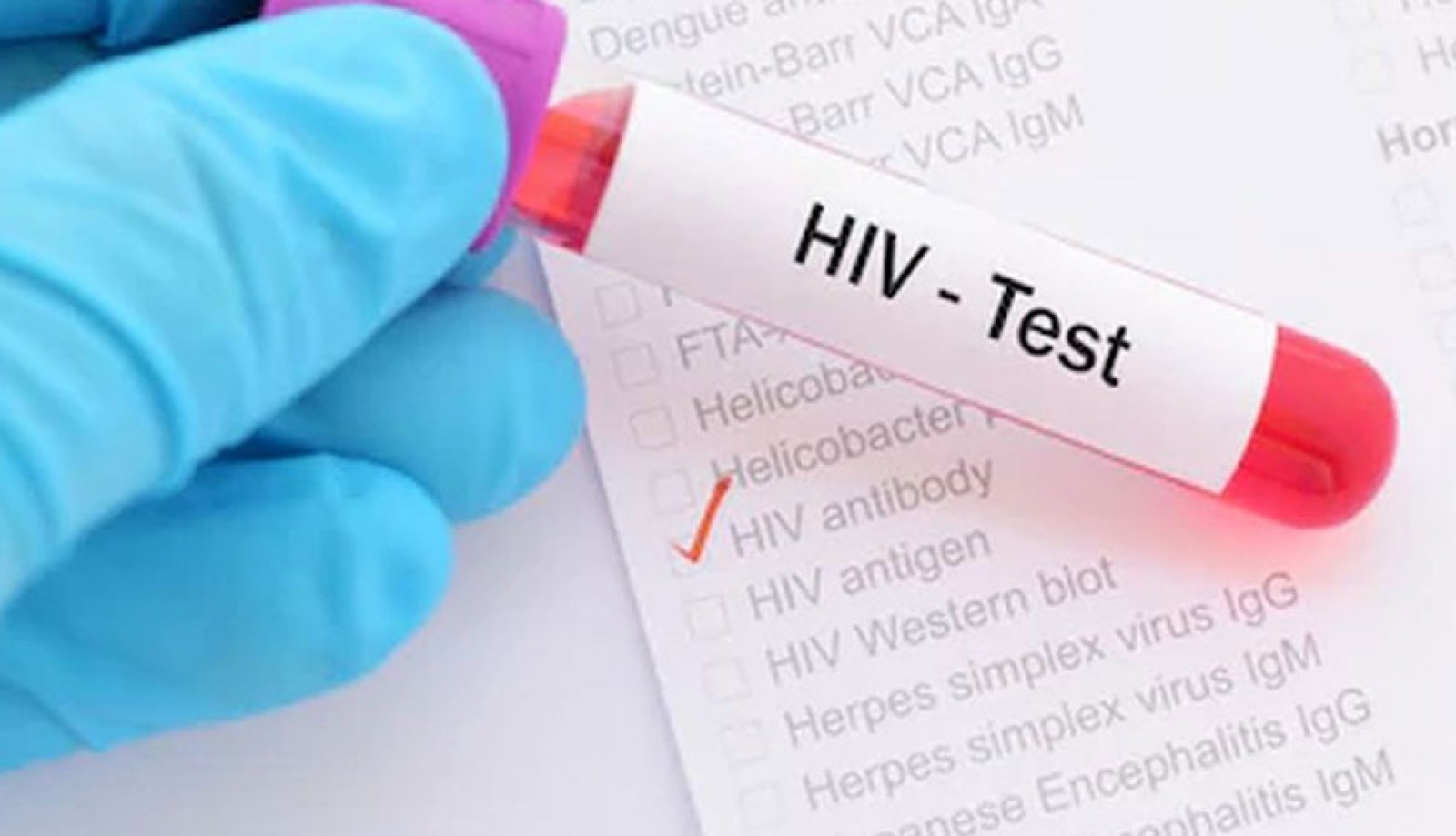 Αλήθειες και μύθοι για την HIV Λοίμωξη (ΑIDS)