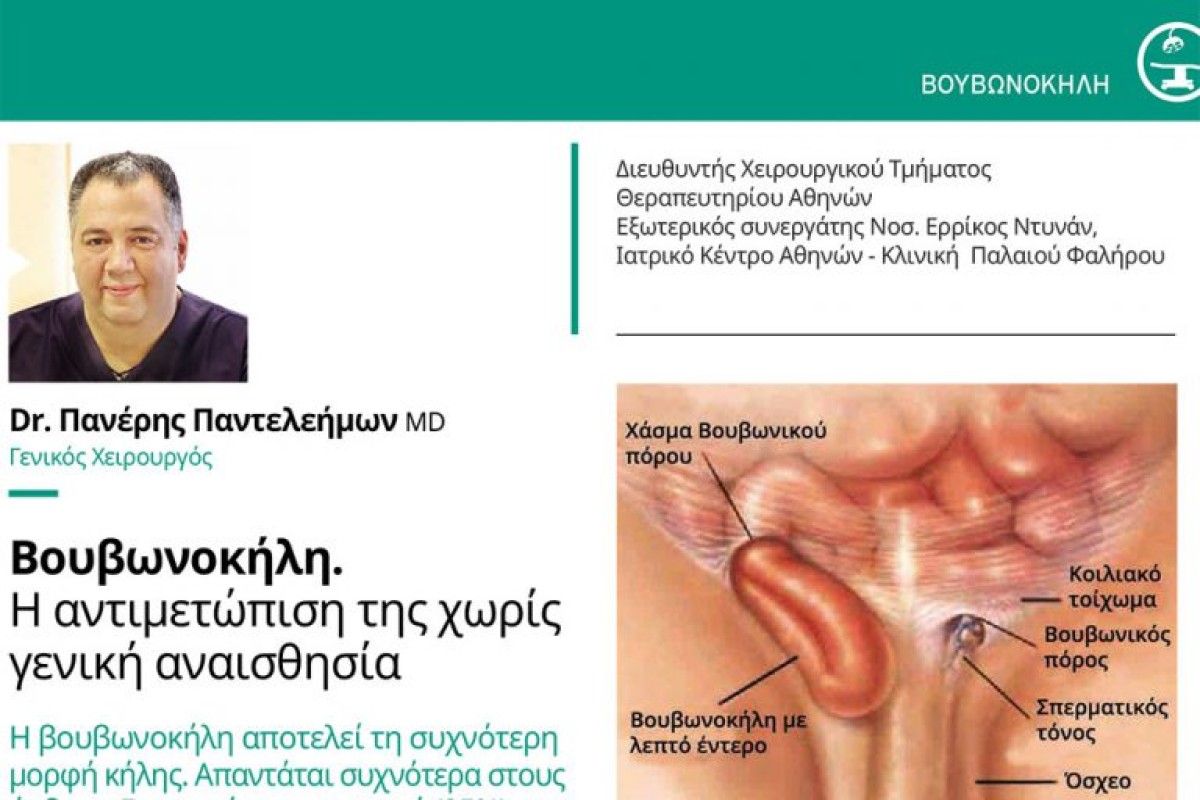 Βουβωνοκήλη: η αντιμετώπισή της χωρίς γενική αναισθησία!