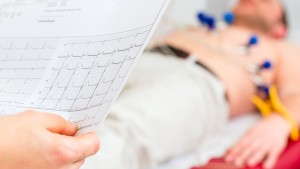 &Pi;&rho;&omicron;&sigma;&phi;&omicron;&rho;ά Ά&nu;&omicron;&iota;&xi;&eta;&sigmaf; &gamma;&iota;&alpha; &epsilon;&xi;&epsilon;&tau;ά&sigma;&epsilon;&iota;&sigmaf; &pi;&rho;&omicron;&lambda;&eta;&pi;&tau;&iota;&kappa;&omicron;ύ &epsilon;&lambda;έ&gamma;&chi;&omicron;&upsilon;