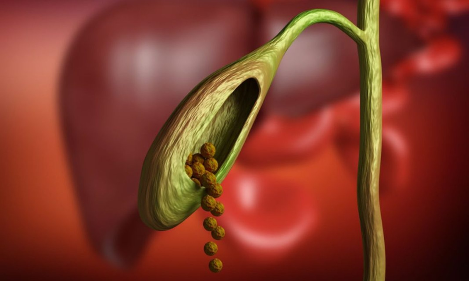 &Chi;&omicron;&lambda;&omicron;&lambda;&iota;&theta;ί&alpha;&sigma;&eta;: &Pi;ό&tau;&epsilon; &epsilon;&pi;&iota;&lambda;έ&gamma;&omicron;&upsilon;&mu;&epsilon; &tau;&eta; &chi;&epsilon;&iota;&rho;&omicron;&upsilon;&rho;&gamma;&iota;&kappa;ή &alpha;&nu;&tau;&iota;&mu;&epsilon;&tau;ώ&pi;&iota;&sigma;&eta;; (dimokratia.gr) 25.01.23