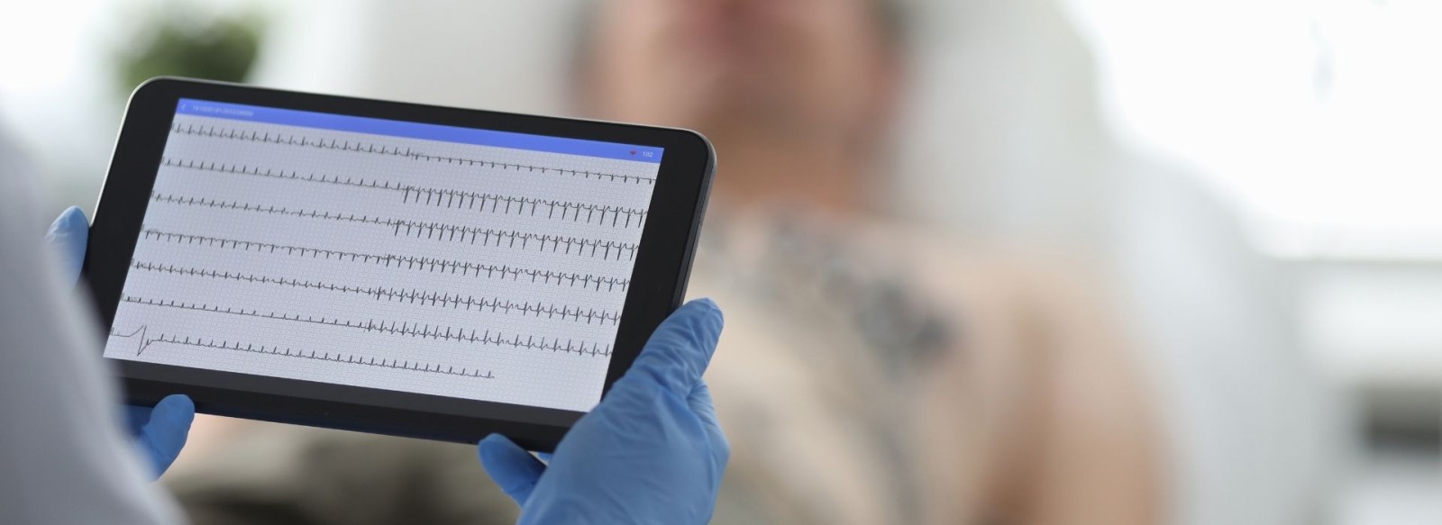 24&omega;&rho;&eta; &kappa;&alpha;&tau;&alpha;&gamma;&rho;&alpha;&phi;ή &eta;&lambda;&epsilon;&kappa;&tau;&rho;&omicron;&kappa;&alpha;&rho;&delta;&iota;&omicron;&gamma;&rho;&alpha;&phi;ή&mu;&alpha;&tau;&omicron;&sigmaf; (Holter &rho;&upsilon;&theta;&mu;&omicron;ύ)